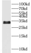 UCMA Antibody - BSA Free