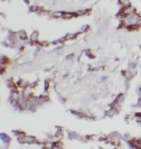 UBXD5 Antibody - BSA Free