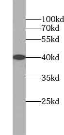 UBXN10 Antibody - BSA Free