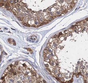 UBQLNL Antibody - BSA Free