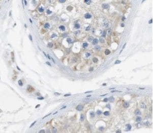 UBQLN3 Antibody - BSA Free