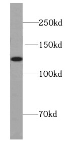 UBN1 Antibody - BSA Free