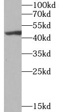 UBE2U Antibody - BSA Free