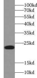 UbcH2/UBE2H Antibody - BSA Free