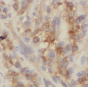 UbcH2/UBE2H Antibody - BSA Free