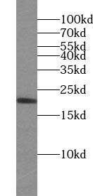 UBE2G1 Antibody - BSA Free