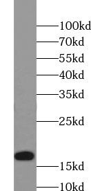 UbcH5c/UBE2D3 Antibody - BSA Free