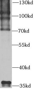 Ubiquitin C Antibody - BSA Free