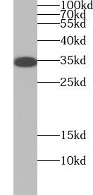 UBAC2 Antibody - BSA Free