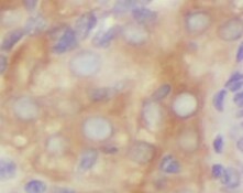 TYW1B Antibody - BSA Free