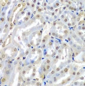 TUSC2 Antibody - BSA Free