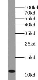 TUSC2 Antibody - BSA Free
