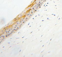 TULP1 Antibody - BSA Free