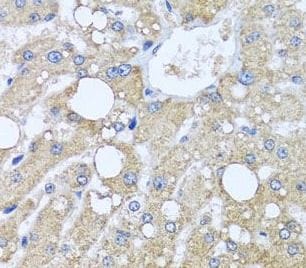 TUBGCP3 Antibody - BSA Free
