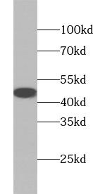 TTLL10 Antibody - BSA Free