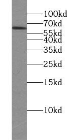 TTC39B Antibody - BSA Free