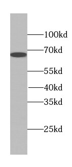 TTC39A Antibody - BSA Free