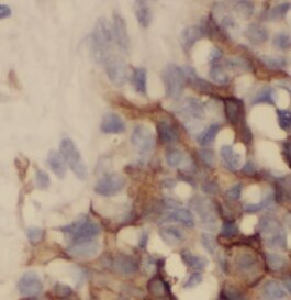 TTC39A Antibody - BSA Free