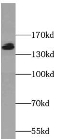 TTC37 Antibody - BSA Free