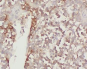 TTC37 Antibody - BSA Free