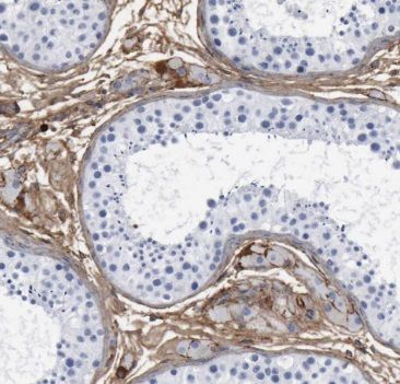 TTC32 Antibody - BSA Free