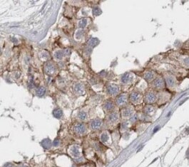 TTC31 Antibody - BSA Free
