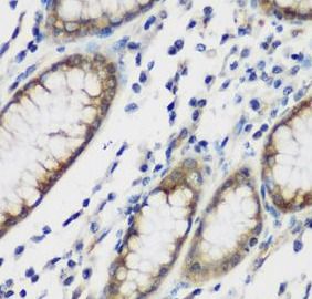Tau tubulin kinase 2 Antibody - BSA Free