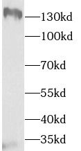 Tau tubulin kinase 2 Antibody - BSA Free