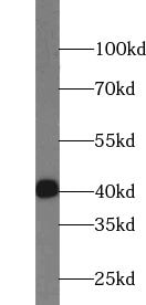 TSPY3 Antibody - BSA Free