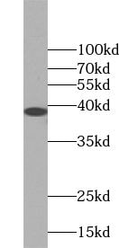 Tetraspanin-5 Antibody - BSA Free