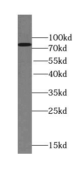 TSNAXIP1 Antibody - BSA Free