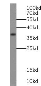 TRUB1 Antibody - BSA Free