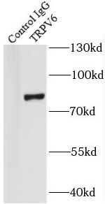 TRPV6 Antibody - BSA Free