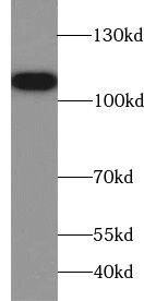 TROAP Antibody - BSA Free