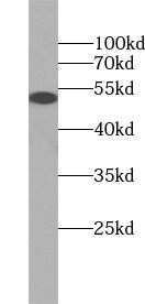 TRM11 Antibody - BSA Free