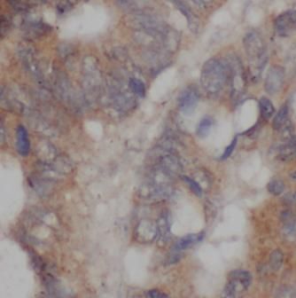 RNF89 Antibody - BSA Free