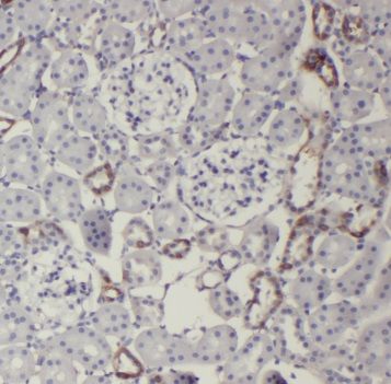 TRIM2 Antibody - BSA Free