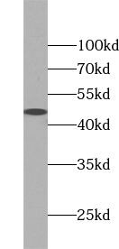 TRIB2 Antibody - BSA Free