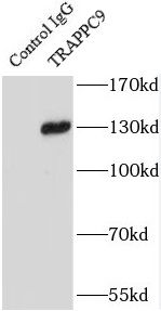TRAPPC9 Antibody - BSA Free