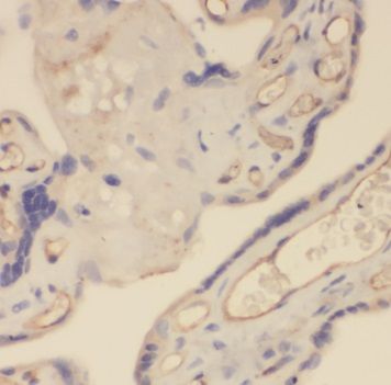 TRAPPC3 Antibody - BSA Free