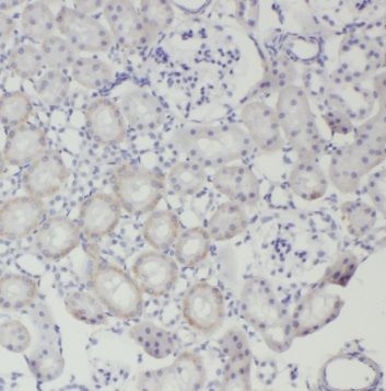 TRAPPC2L Antibody - BSA Free
