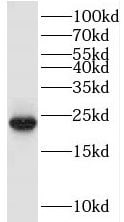 TRAPPC1 Antibody - BSA Free