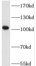 ALS2CR3 Antibody - BSA Free
