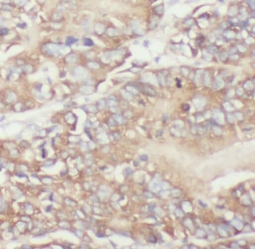 TPK1 Antibody - BSA Free