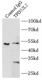 TPD52L2/D54 Antibody - BSA Free