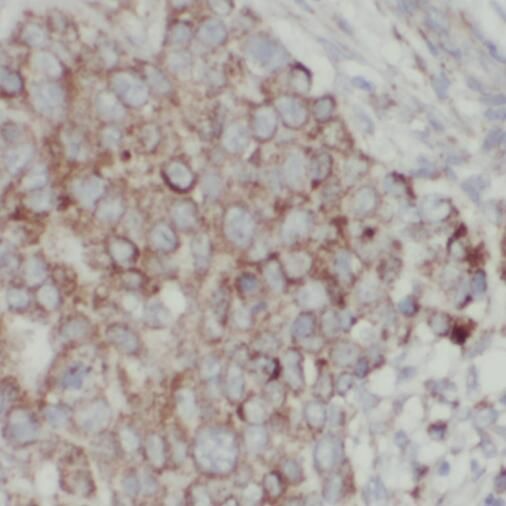TPD52L2/D54 Antibody - BSA Free