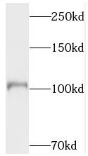 Topoisomerase III alpha Antibody - BSA Free