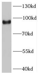 SV2C Antibody - BSA Free