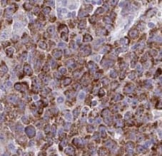 STT3B Antibody - BSA Free