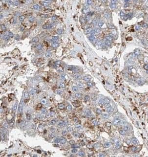 STT3A Antibody - BSA Free